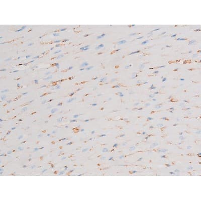 PRKCQ / PKC-Theta Antibody (phospho-Ser676)