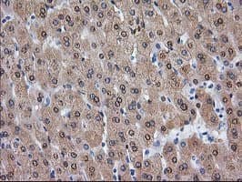 ADH2 / ADH1B Antibody (clone OTI3F2)