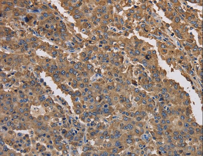 K13 / KCNG Antibody