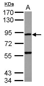 Polyclonal Rabbit anti-Human RASA4 / CAPRI Antibody (N-Terminus, WB)