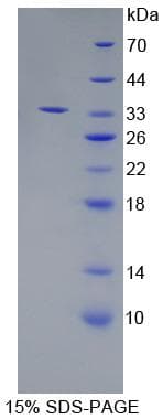 Human ERAP2 / Aminopeptidase Protein (Recombinant His-T7)