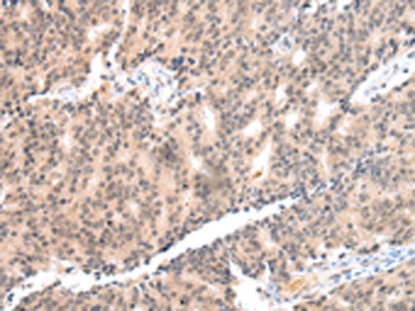 COX17 Antibody