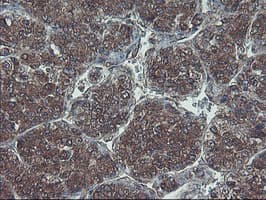 HDHD1 Antibody (clone OTI7A2)