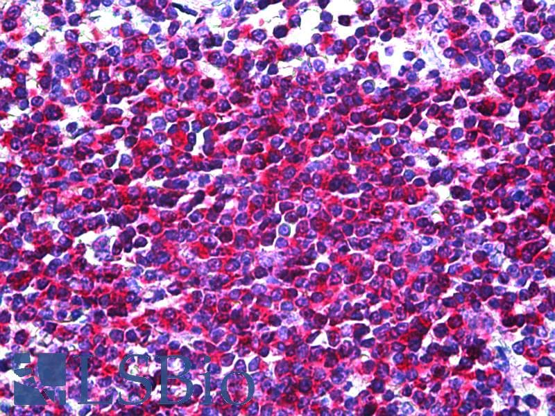 IHC-plus™ Monoclonal Mouse IL16 Antibody (clone G11/II, IHC)