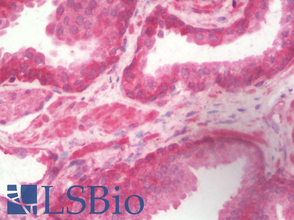 KANK1 Antibody