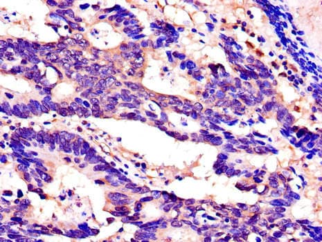 SPINK1 Antibody