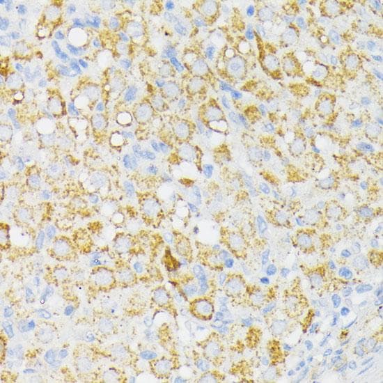 Polyclonal Rabbit anti-Human USP33 / VDU1 Antibody (IHC, IF, WB)