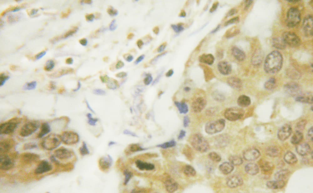 RELA / NFKB p65 Antibody (phospho-Ser281)