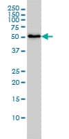 SARS / Serine-tRNA Ligase Antibody (clone 1H4)