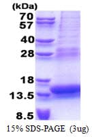 Human PLAC8 Protein (Recombinant His)