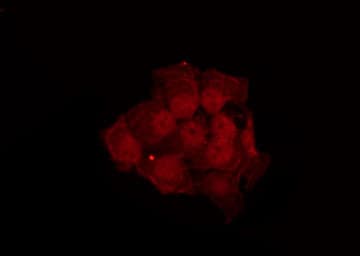 Polyclonal Rabbit anti-Human NOS1 / nNOS Antibody (IF, WB)