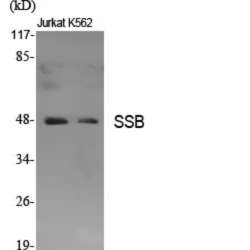 SSB / La Antibody (310-390 aa)