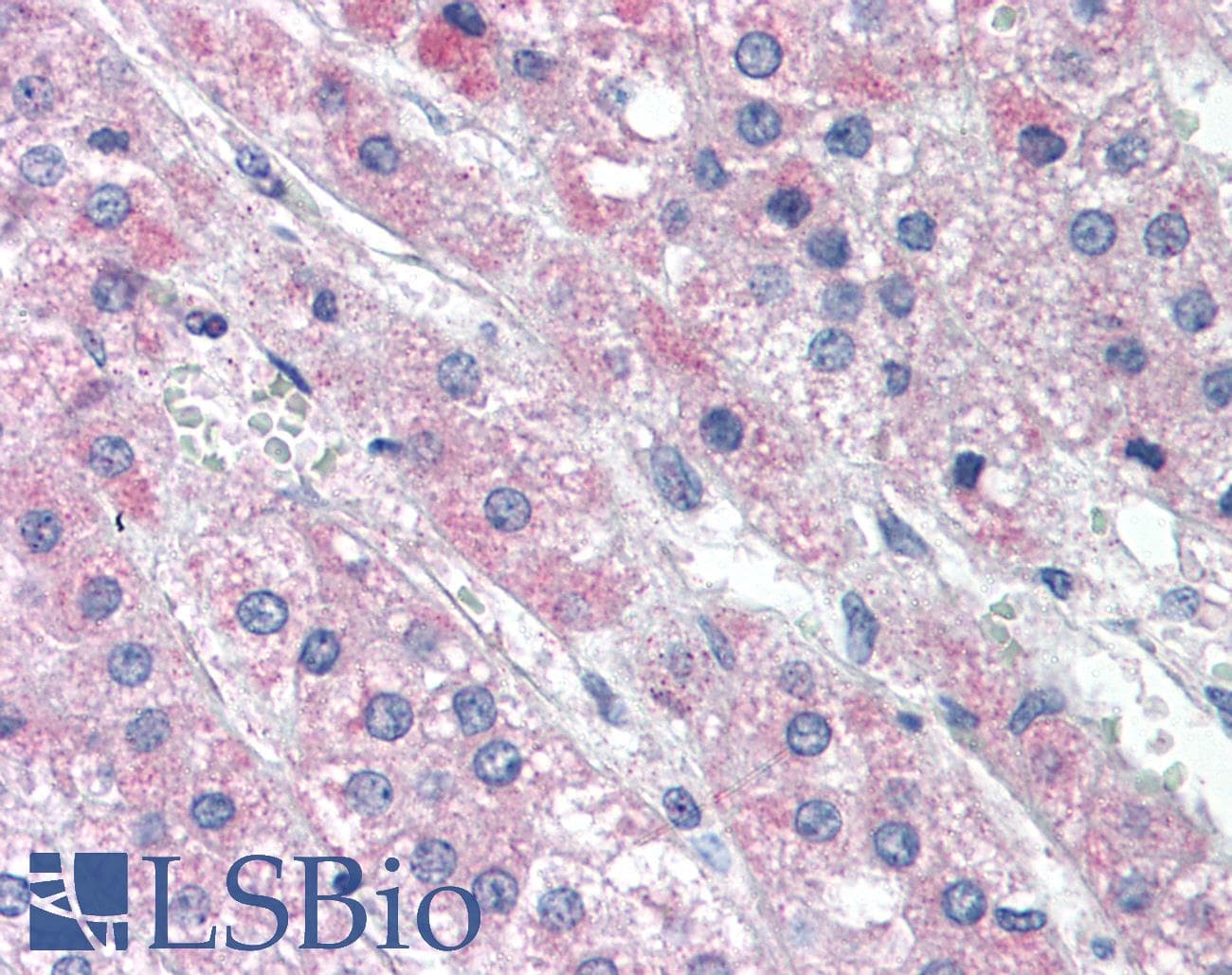 IHC-plus™ Apg7 / ATG7 Antibody