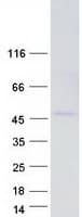 Human DSN1 Protein (Recombinant Myc-DDK (Flag))