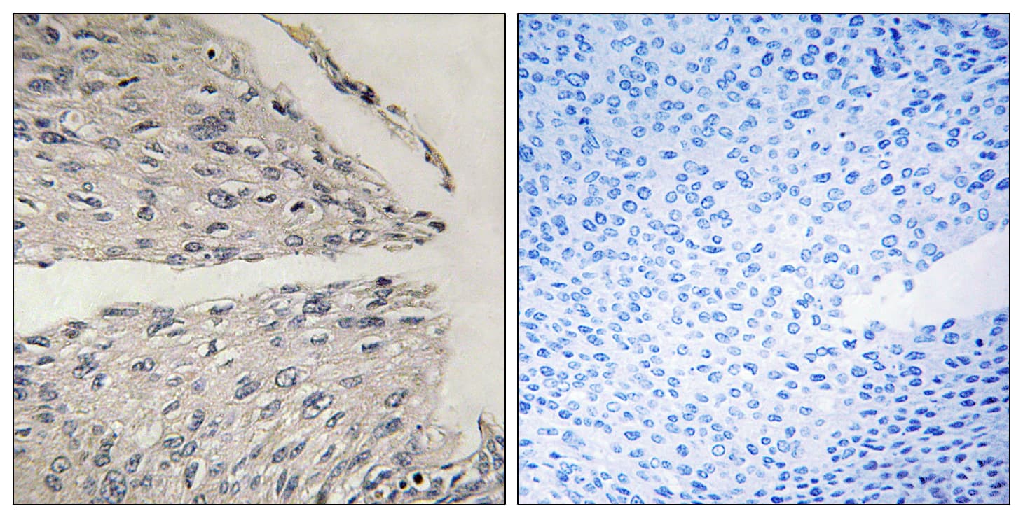 CIDEB Antibody (aa91-140)