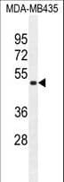 TAPT1 Antibody (aa530-558)