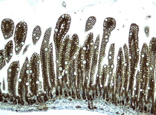CTNNB1 / Beta Catenin Antibody (clone UMAB14)
