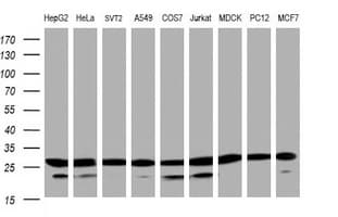 PSMA2 Antibody (clone OTI3B3)