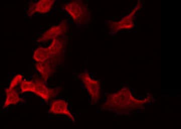 LDLRAD2 Antibody