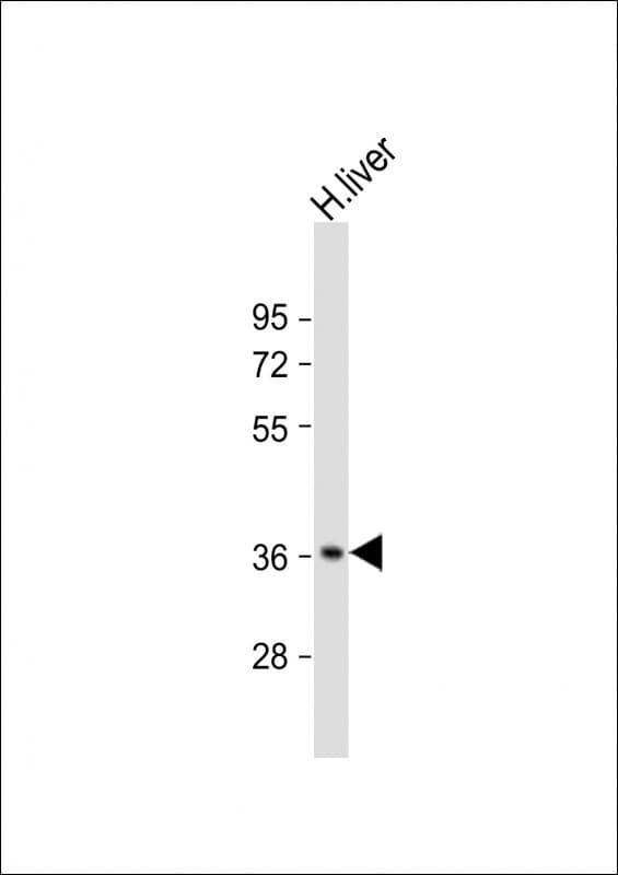 CTBS / CTB Antibody (N-Terminus)