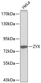 Polyclonal Rabbit anti-Human Zyxin Antibody (IHC, IF, WB)