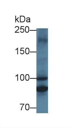 MTIF2 Antibody (Biotin)