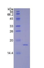 Mouse F8 / FVIII / Factor VIII Protein (Recombinant His)