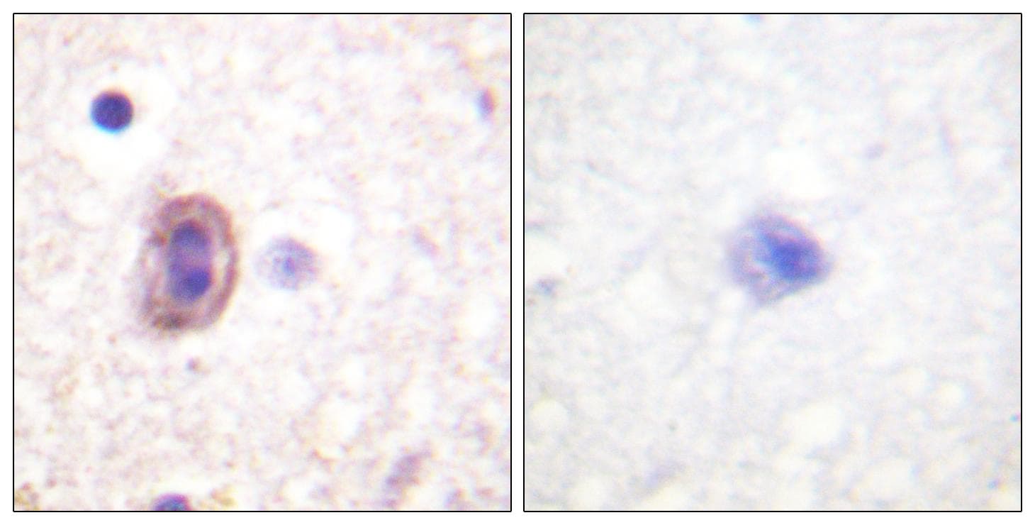 MAP2K4 / MKK4 Antibody