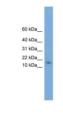 Polyclonal Rabbit anti-Human HRSP12 / UK114 Antibody (N-Terminus, WB)