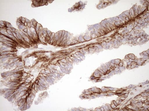 Monoclonal Mouse anti-Human EPLIN Antibody (clone OTI9F3, aa1-275, IHC, WB)