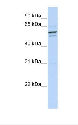 GPNMB / Osteoactivin Antibody (aa74-123)