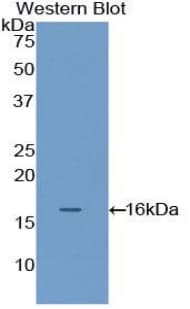 FLNB / TAP Antibody (aa1-237, Biotin)
