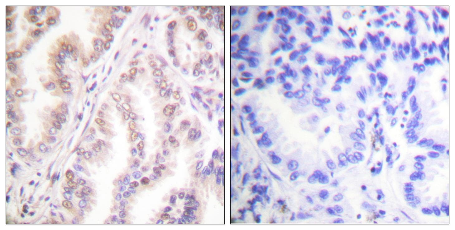 PIAS1 Antibody