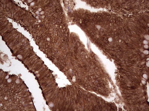 LGALS9 / Galectin 9 Antibody (clone OTI1D12)