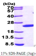 Human SHH / Sonic Hedgehog Protein (Recombinant His)
