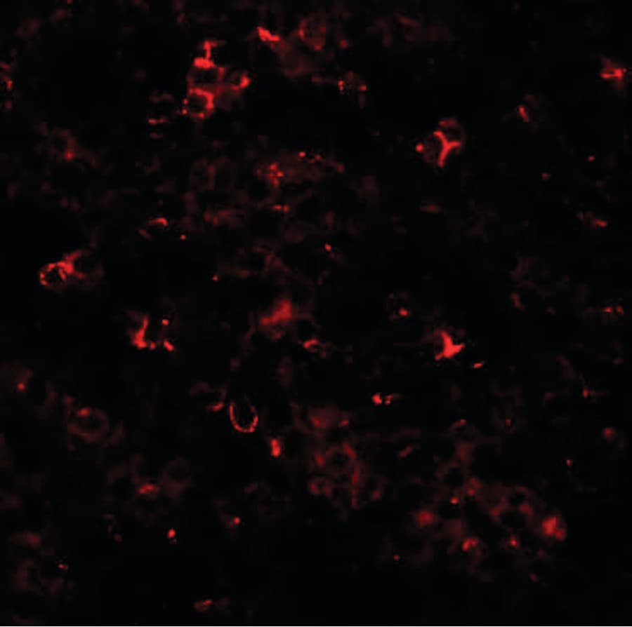 IHC-plus™ SLC39A10 / ZIP10 Antibody