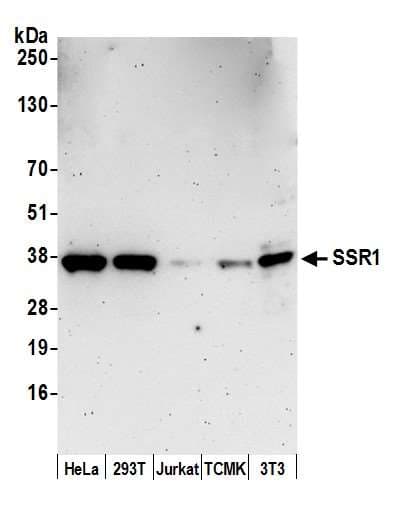SSR1 Antibody (aa236-286)