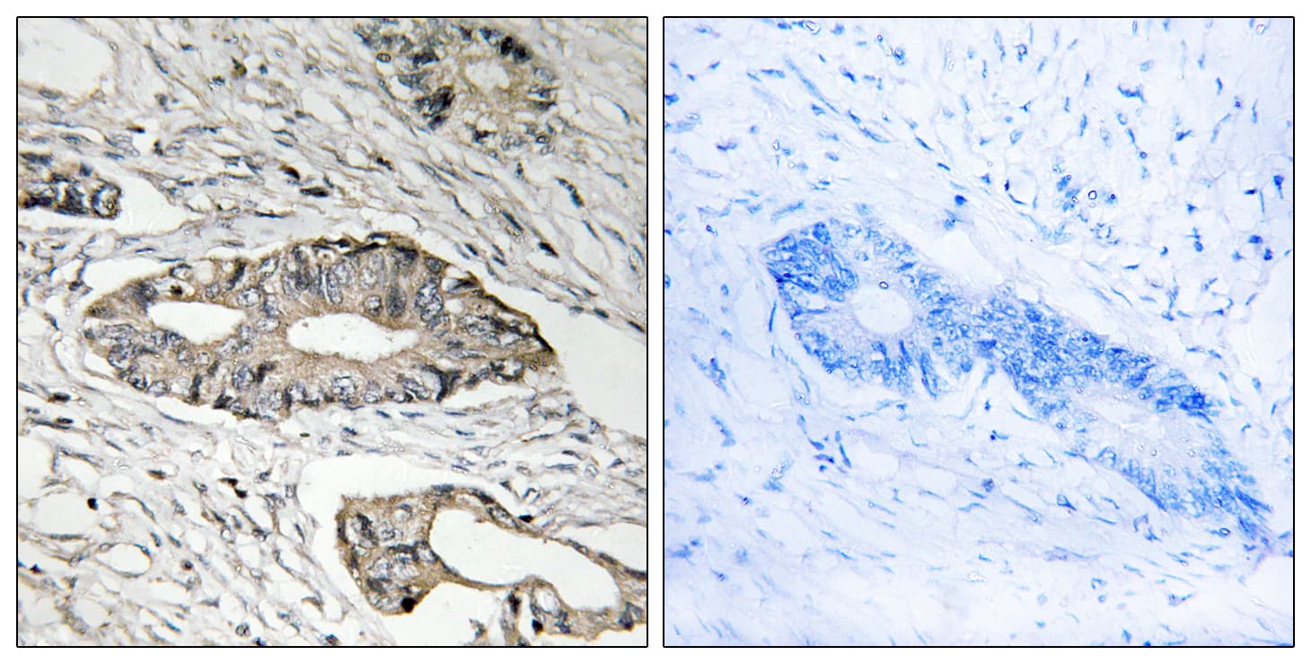 EPN3 Antibody (aa401-450)