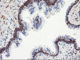 PFKP Antibody (clone OTI3H8)
