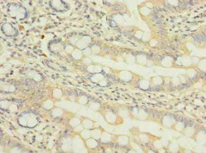 Polyclonal Rabbit anti-Human NUPL1 Antibody (aa211-480, IHC, WB)