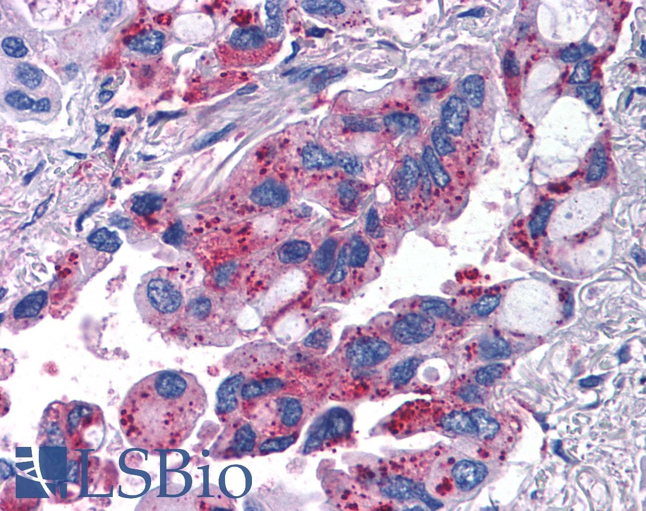 PathPlus™ MRGPRX2 / MRGX2 Antibody (Extracellular Domain)