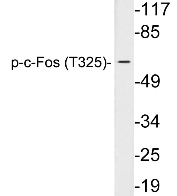 FOS / c-FOS Antibody (phospho-Thr325)