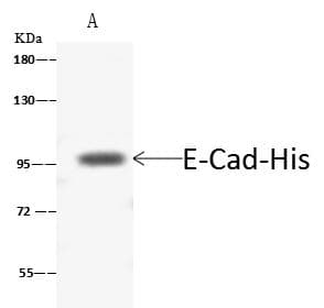 Polyclonal Rabbit anti-Human CDH1 / E Cadherin Antibody (WB)