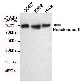 HK2 / Hexokinase 2 Antibody