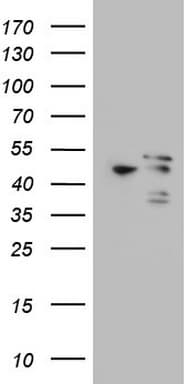 MAPKAPK5 / PRAK Antibody (aa197-471, clone OTI1B3)