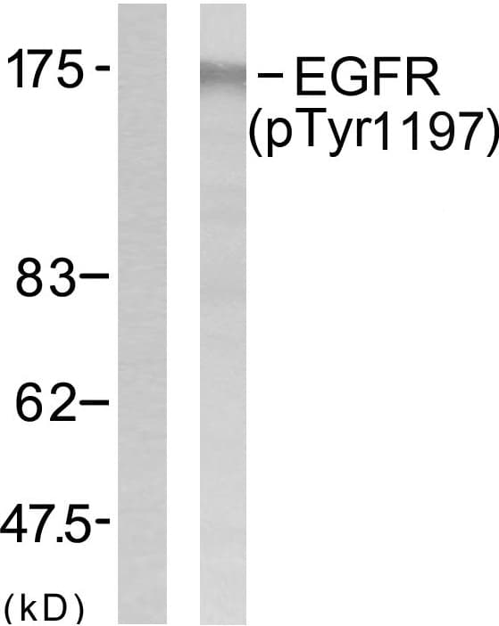 EGFR Antibody (phospho-Tyr1197)