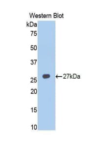 TNFRSF14 / CD270 / HVEM Antibody (aa45-262)