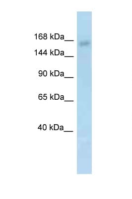 Polyclonal Rabbit anti-Mouse KDM6A / UTX Antibody (aa245-294, IHC, WB)