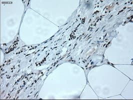 NEUROG1 / NGN1 / Neurogenin 1 Antibody (clone OTI19A11)