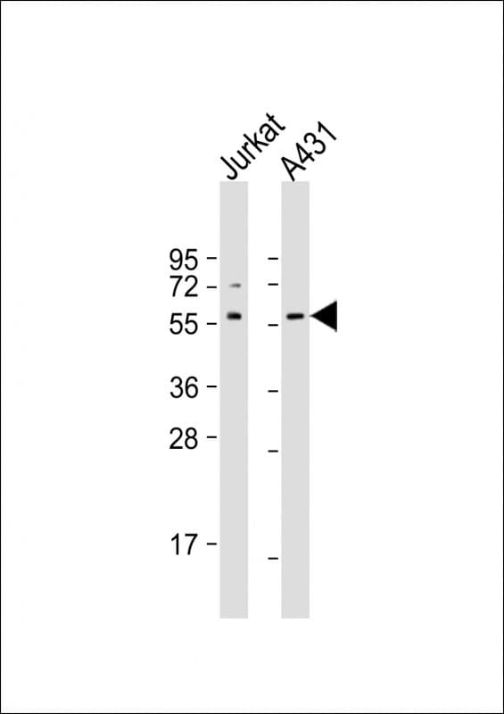 SRC Antibody (aa1-350, clone 1602CT774.225.92)
